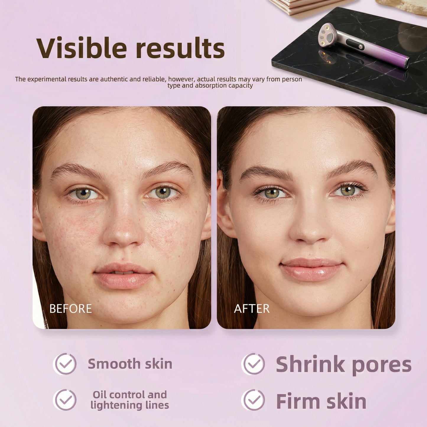 Natfloria  Micro-current Eye & Face Sculpting Tool